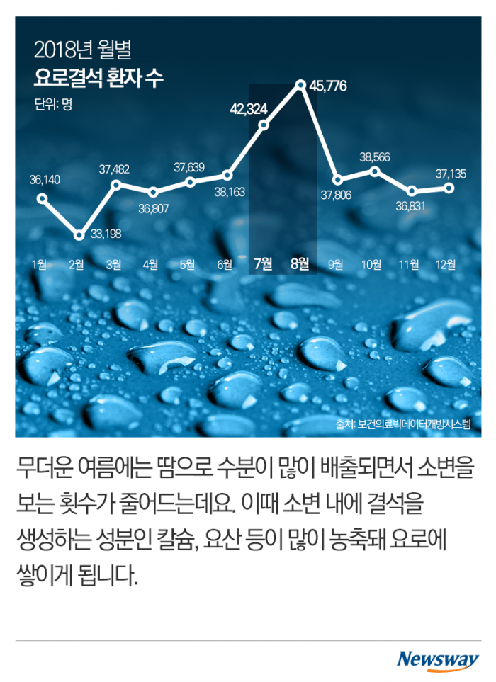 여름에 심해지는 고통···‘요로결석’의 공포 기사의 사진