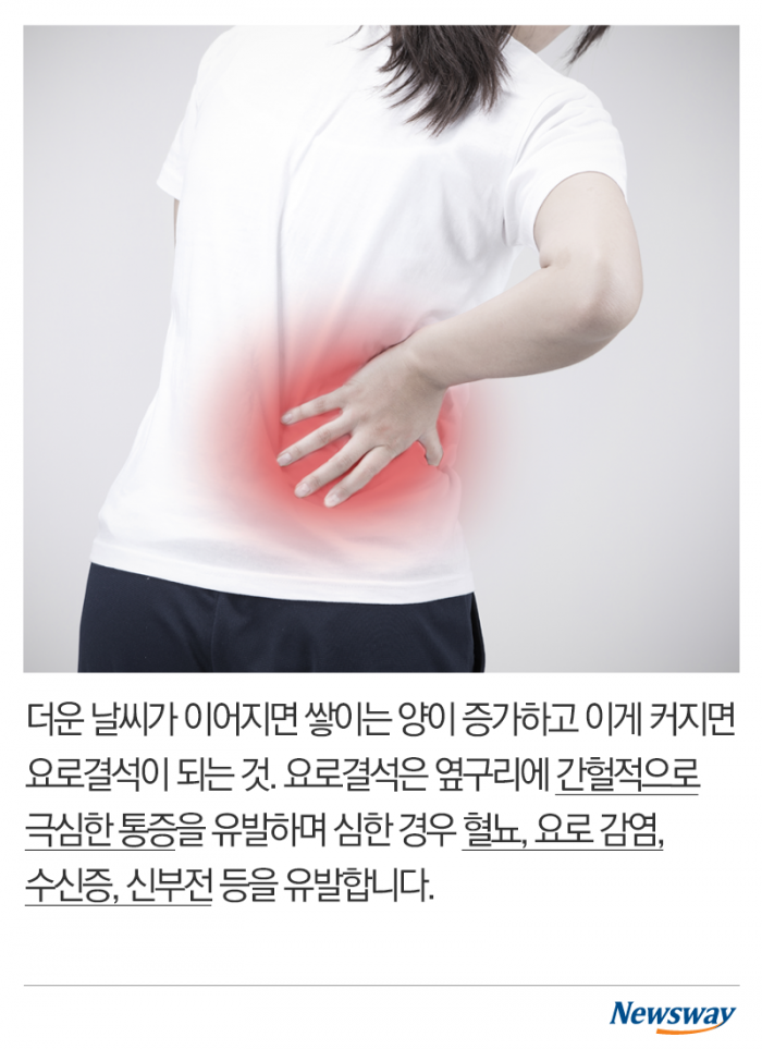 여름에 심해지는 고통···‘요로결석’의 공포 기사의 사진
