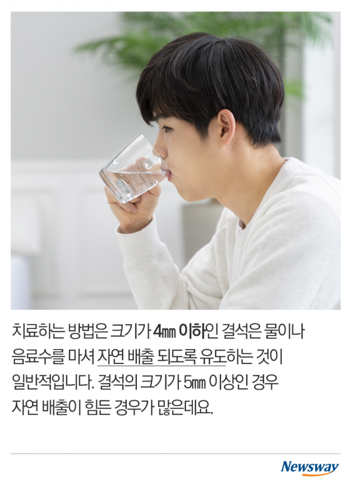 여름에 심해지는 고통···‘요로결석’의 공포 기사의 사진