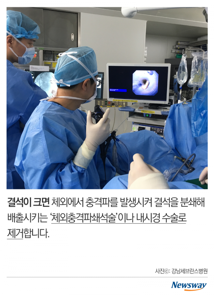 여름에 심해지는 고통···‘요로결석’의 공포 기사의 사진