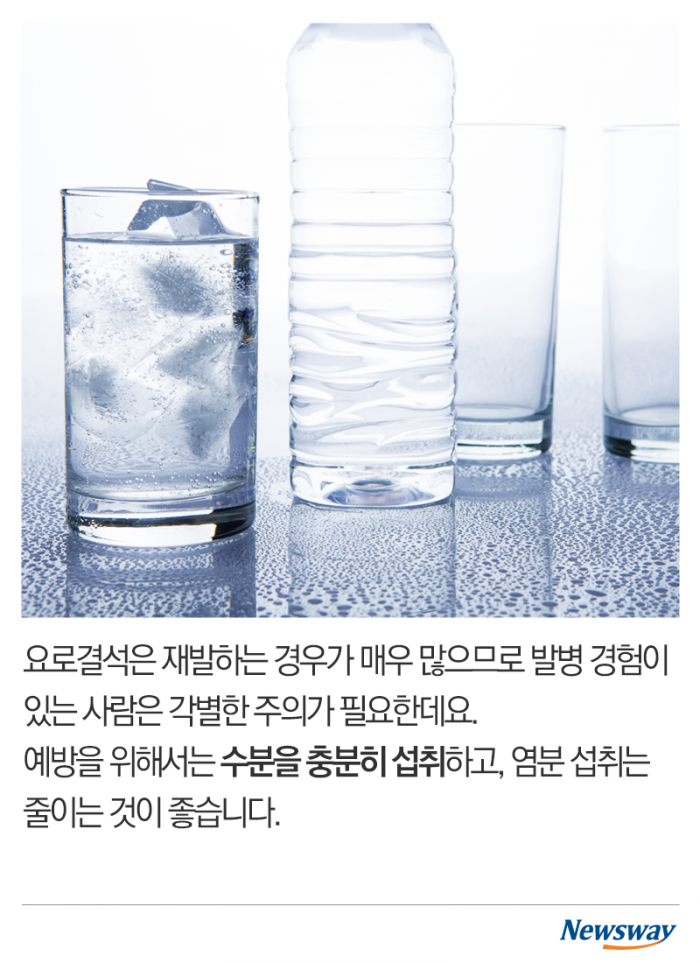 여름에 심해지는 고통···‘요로결석’의 공포 기사의 사진