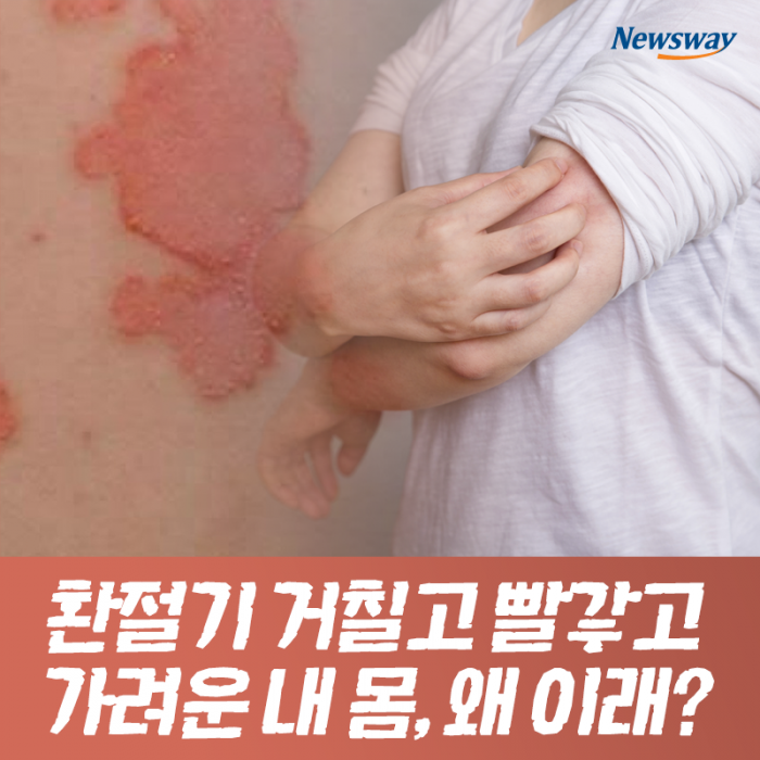 환절기 거칠고 빨갛고 가려운 내 몸, 왜 이래? 기사의 사진