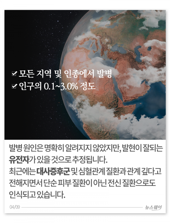 환절기 거칠고 빨갛고 가려운 내 몸, 왜 이래? 기사의 사진