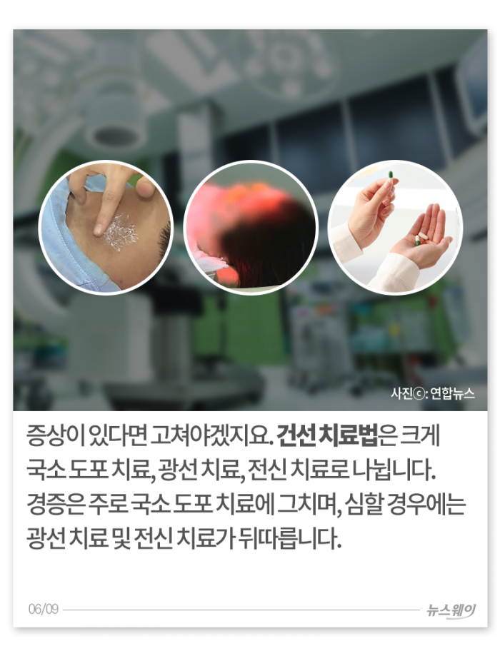 환절기 거칠고 빨갛고 가려운 내 몸, 왜 이래? 기사의 사진