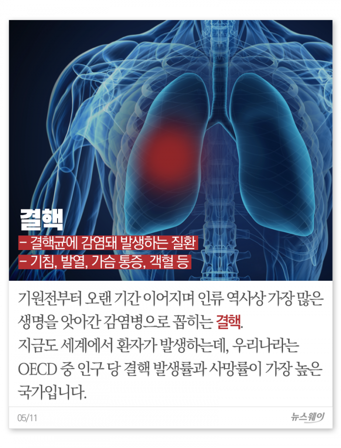천연두부터 코로나까지···인류를 위협한 전염병들 기사의 사진