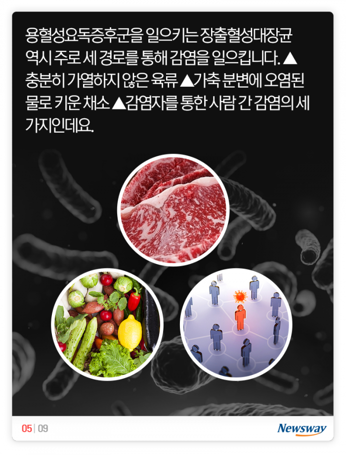 유치원생 용혈성요독증후군···햄버거 안 먹었는데 왜? 기사의 사진