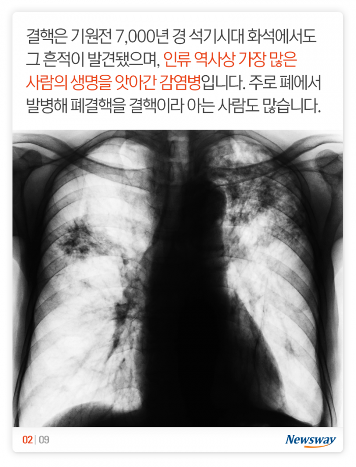 인류 역사상 가장 많은 생명을 앗아갔다는 ‘이 질병’ 기사의 사진