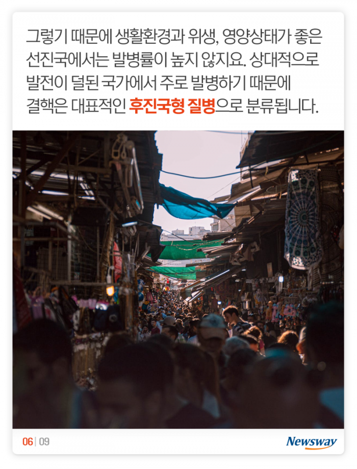 인류 역사상 가장 많은 생명을 앗아갔다는 ‘이 질병’ 기사의 사진