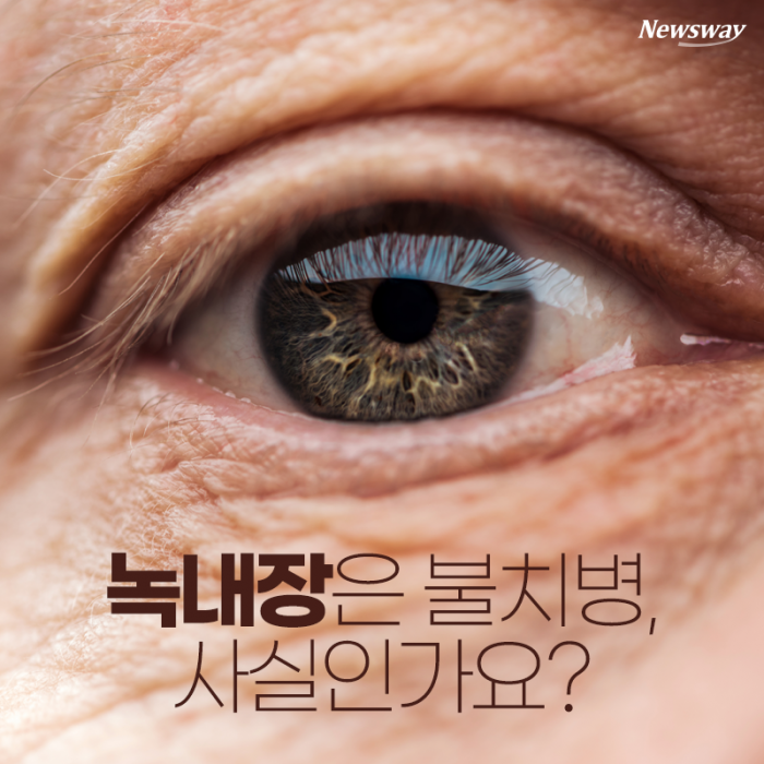 녹내장은 불치병, 사실인가요? 기사의 사진