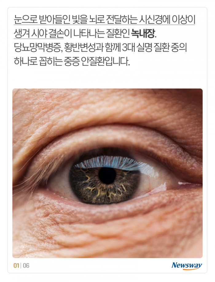 녹내장은 불치병, 사실인가요? 기사의 사진