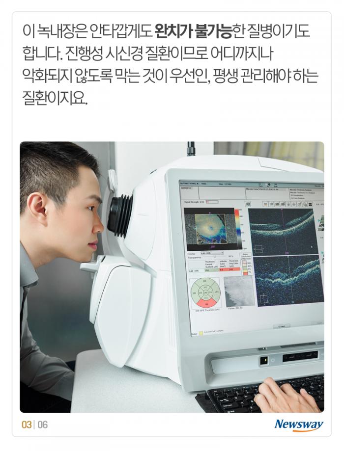 녹내장은 불치병, 사실인가요? 기사의 사진