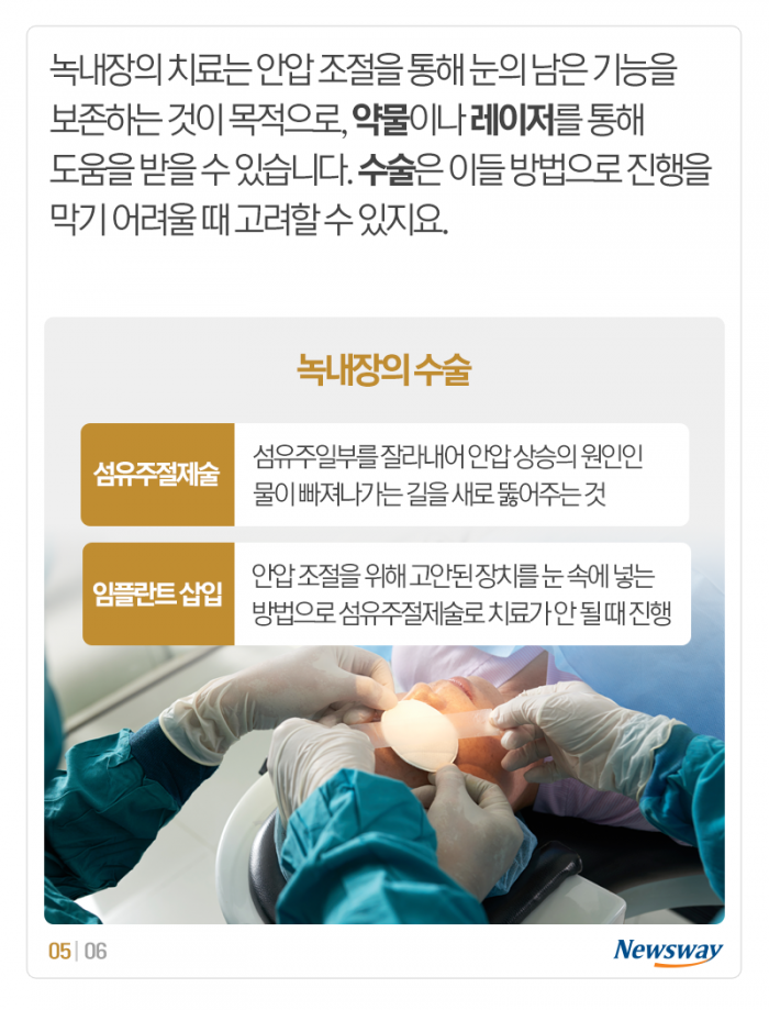 녹내장은 불치병, 사실인가요? 기사의 사진