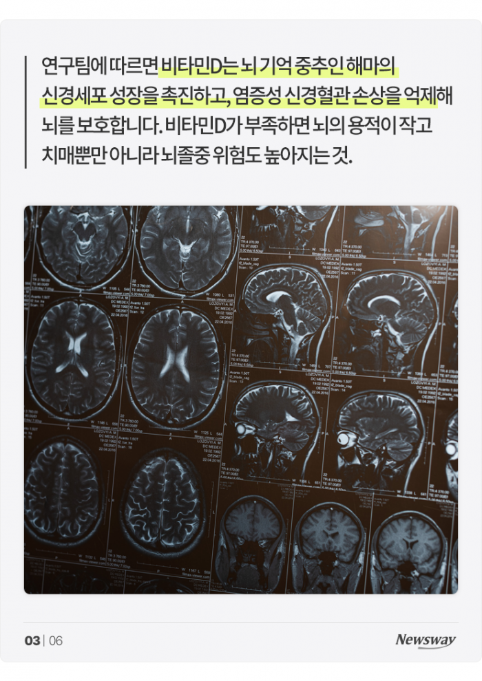 치매 위험 줄이고 싶다면 '이것' 드세요 기사의 사진