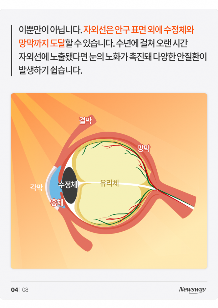 내 눈을 늙게 만드는 그 이름, 여름 '○○○' 기사의 사진