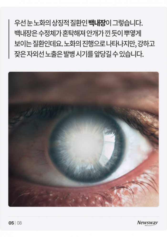 내 눈을 늙게 만드는 그 이름, 여름 '○○○' 기사의 사진