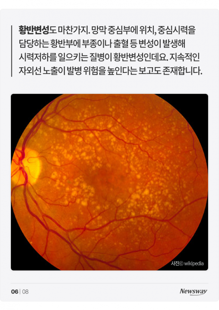 내 눈을 늙게 만드는 그 이름, 여름 '○○○' 기사의 사진