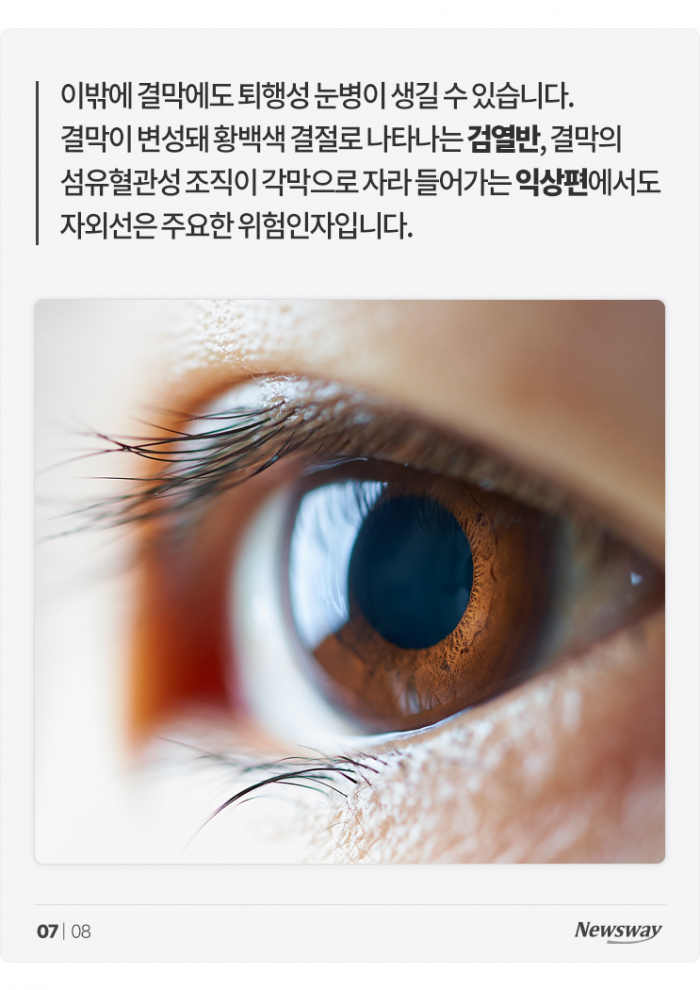 내 눈을 늙게 만드는 그 이름, 여름 '○○○' 기사의 사진