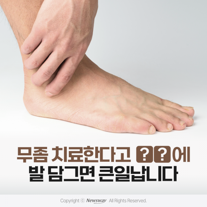 무좀 치료한다고 ○○에 발 담그면 큰일납니다 기사의 사진
