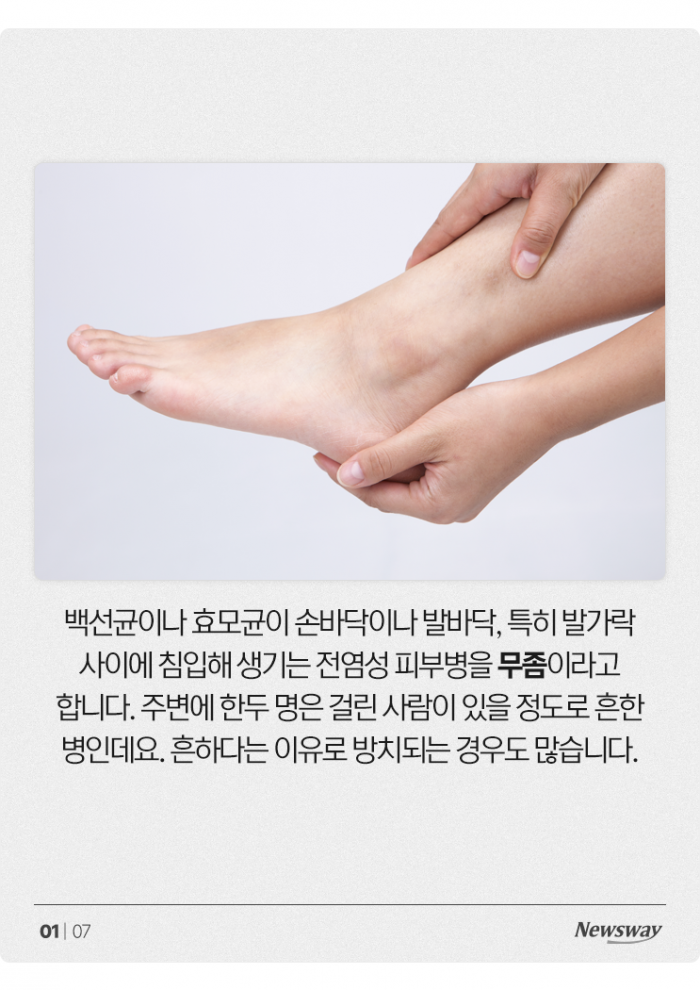 무좀 치료한다고 ○○에 발 담그면 큰일납니다 기사의 사진