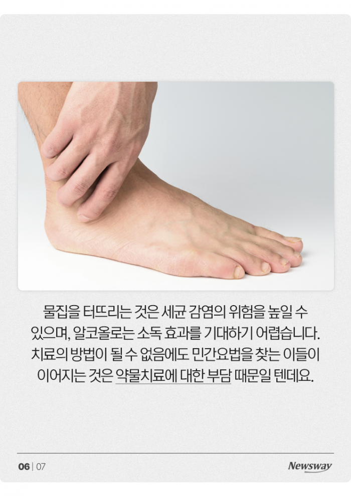 무좀 치료한다고 ○○에 발 담그면 큰일납니다 기사의 사진