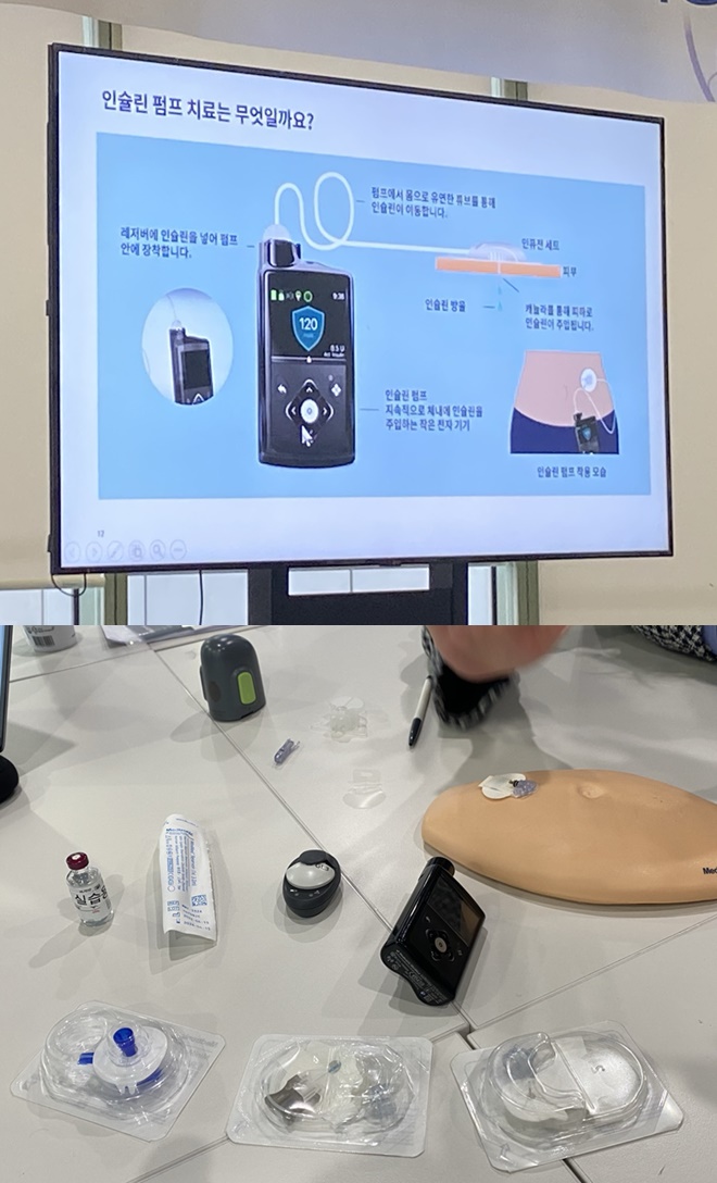 인슐린 펌프 시스템