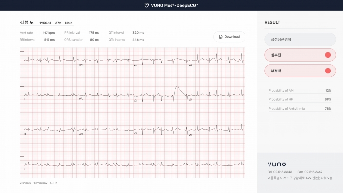 뷰노메드 딥ECG™ 운영화면 예시. 사진=뷰노 제공