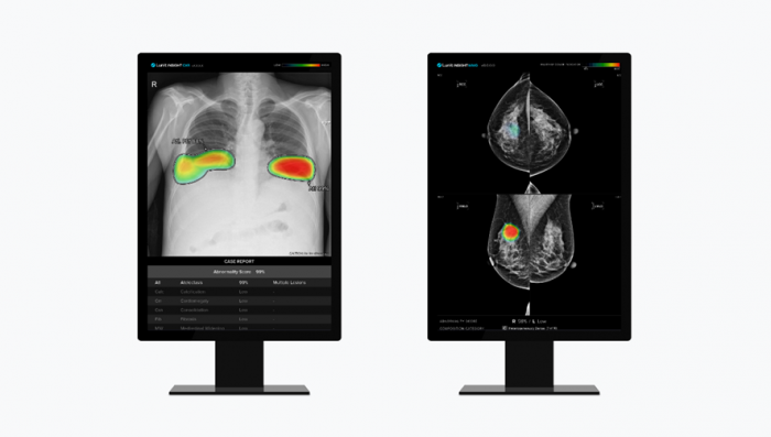 Lunit INSIGHT CXR & Lunit INSIGHT MMG. 루닛 제공